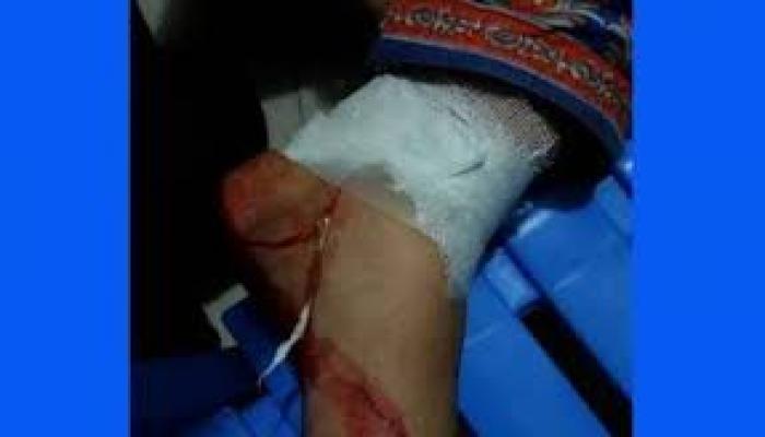 মুরাদনগরে ৮ বছরের শিশুকে ধর্ষণ, প্রতিবাদ করায়   মামার পায়ের রগ কেটে দিয়েছে ধর্ষকের বাবা