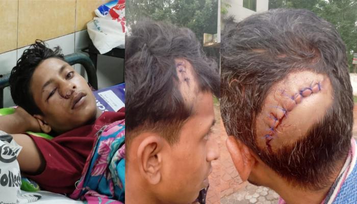লালমাইয়ে ধান কাঁটতে গিয়ে প্রতিপক্ষের দাঁড়ালো অস্ত্রের আঘাতে গুরুতর আহত ৩