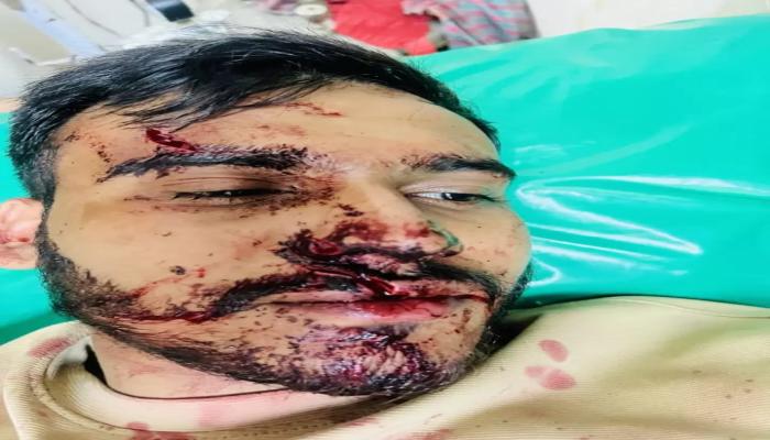 বাঙ্গরায় পুকুরে গোসলকে কেন্দ্র করে সন্ত্রাসী হামলা,আহত ৩