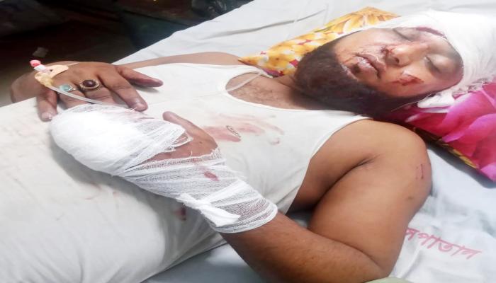 কুমিল্লার আড়াইওড়ায় সম্পত্তি নিয়ে বিরোধ  ভাইকে কুপিয়ে জখমের অভিযোগ